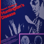 Chorea Huntington