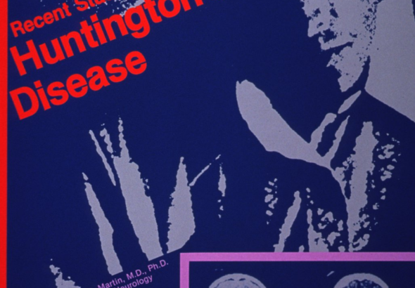 Chorea Huntington