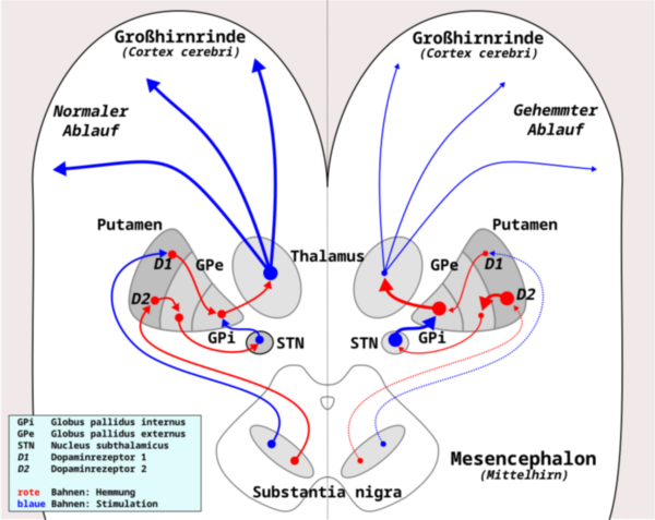 Schematische Darstellung der Dopamin-Signalübertragung bei Parkinson